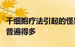 干细胞疗法引起的怪异副作用比我们想象的要普遍得多