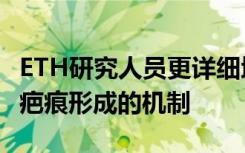 ETH研究人员更详细地解构了控制伤口愈合和疤痕形成的机制