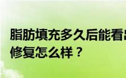 脂肪填充多久后能看出来过量？张正鹏院长做修复怎么样？