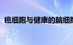 癌细胞与健康的脑细胞形成令人惊讶的联系