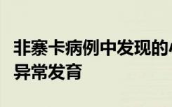 非寨卡病例中发现的小头畸形有助于解释大脑异常发育