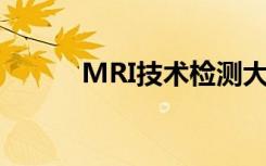 MRI技术检测大脑中的电磁信号