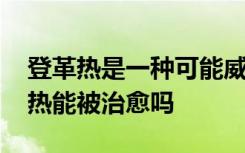 登革热是一种可能威胁生命的疾病 那么登革热能被治愈吗