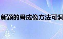 新颖的骨成像方法可洞悉膝盖骨关节炎的进展