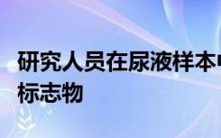 研究人员在尿液样本中发现的帕金森氏病生物标志物