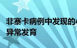 非寨卡病例中发现的小头畸形有助于解释大脑异常发育