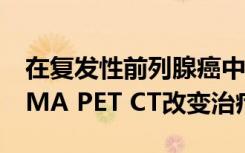 在复发性前列腺癌中 三分之二的病例采用PSMA PET CT改变治疗