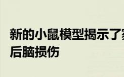 新的小鼠模型揭示了寨卡感染引起的广泛的产后脑损伤