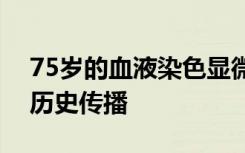 75岁的血液染色显微镜载玻片揭示了疟疾的历史传播