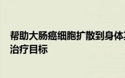 帮助大肠癌细胞扩散到身体其他部位的蛋白质可能是有效的治疗目标