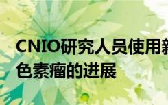 CNIO研究人员使用新的液体活检技术评估黑色素瘤的进展