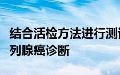 结合活检方法进行测试可改善NIH研究中的前列腺癌诊断