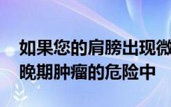 如果您的肩膀出现微妙的征兆 您也可能处于晚期肿瘤的危险中