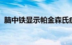 脑中铁显示帕金森氏症患者的认知能力下降