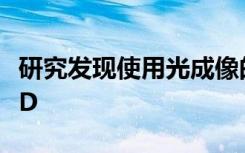 研究发现使用光成像的概念可能可以治疗PTSD