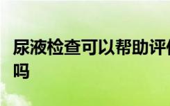 尿液检查可以帮助评估囊性纤维化的各个方面吗