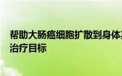 帮助大肠癌细胞扩散到身体其他部位的蛋白质可能是有效的治疗目标