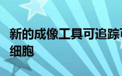 新的成像工具可追踪可能引发肥胖相关疾病的细胞