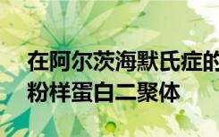 在阿尔茨海默氏症的大脑中确定稳定的β-淀粉样蛋白二聚体