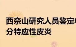 西奈山研究人员鉴定单一基因生物标记物以区分特应性皮炎