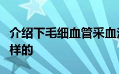 介绍下毛细血管采血法的步骤及注意事项是怎样的