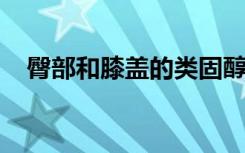 臀部和膝盖的类固醇注射可能会损坏关节