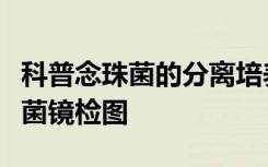 科普念珠菌的分离培养及鉴定如何进行呢念珠菌镜检图