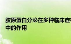 胶原蛋白分泌在多种临床症状中以及在新发现的遗传综合症中的作用