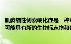 肌萎缩性侧索硬化症是一种难以诊断和治疗的神经系统疾病 可能具有新的生物标志物和药物靶标