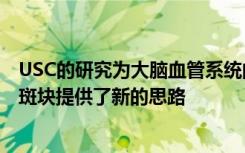 USC的研究为大脑血管系统的崩溃如何提前导致大脑中有毒斑块提供了新的思路