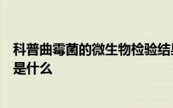 科普曲霉菌的微生物检验结果是什么曲霉菌检验的临床意义是什么