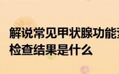 解说常见甲状腺功能紊乱的主要临床生物化学检查结果是什么