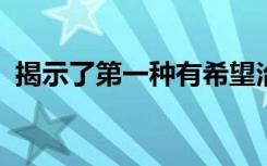 揭示了第一种有希望治疗马尔堡病毒的方法