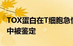 TOX蛋白在T细胞急性淋巴细胞白血病的发展中被鉴定