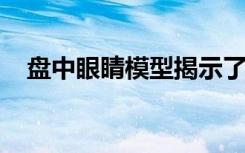 盘中眼睛模型揭示了黄斑变性的遗传基础