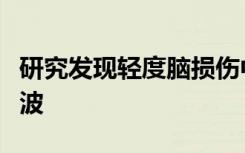 研究发现轻度脑损伤中高水平的异常快速脑电波