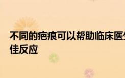 不同的疤痕可以帮助临床医生预测哪些患者对特定治疗的最佳反应