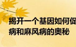 揭开一个基因如何促成帕金森氏症 克罗恩氏病和麻风病的奥秘