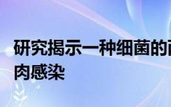 研究揭示一种细菌的两种菌株如何结合导致食肉感染