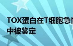 TOX蛋白在T细胞急性淋巴细胞白血病的发展中被鉴定