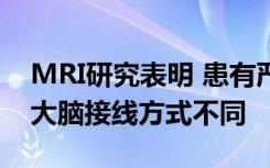 MRI研究表明 患有严重行为问题的年轻人的大脑接线方式不同