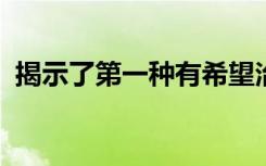 揭示了第一种有希望治疗马尔堡病毒的方法