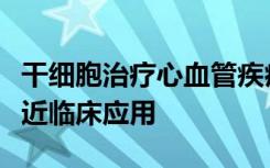 干细胞治疗心血管疾病的前景可能很快就会接近临床应用