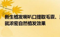 新生植发喇叭口提取毛囊、显微镜分离毛囊、微针种植--成就浓密自然植发效果