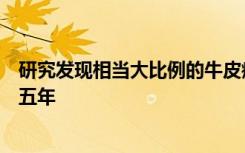 研究发现相当大比例的牛皮癣患者未经治疗平均诊断时间为五年