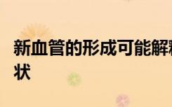 新血管的形成可能解释了帕金森氏症的顽固症状