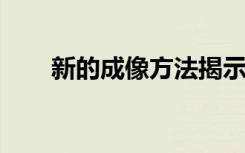 新的成像方法揭示了阿尔茨海默氏病