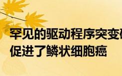 罕见的驱动程序突变破坏了NOTCH信号 从而促进了鳞状细胞癌