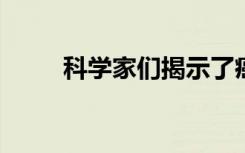 科学家们揭示了癌细胞的免疫弱点