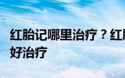 红胎记哪里治疗？红胎记是什么病？知根知底好治疗